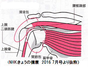 五十肩