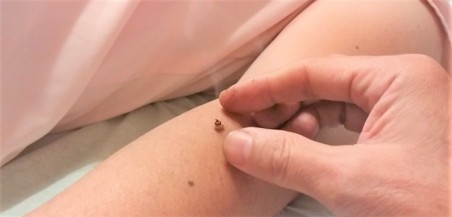 自律神経測定器
