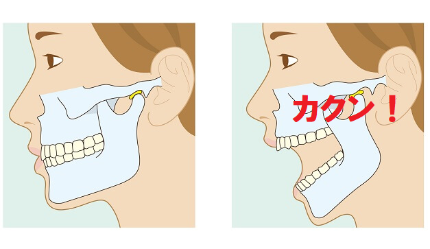 開口時に音がする
