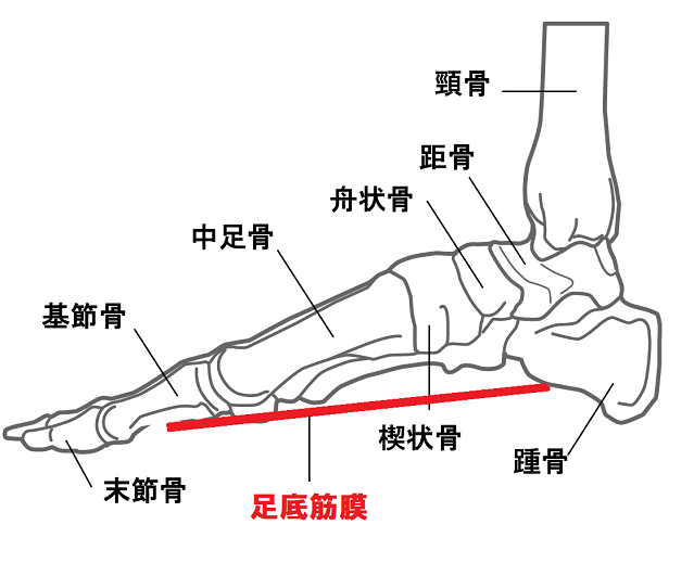 足底筋膜