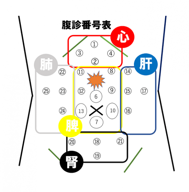 臍上3cmあたりに圧痛