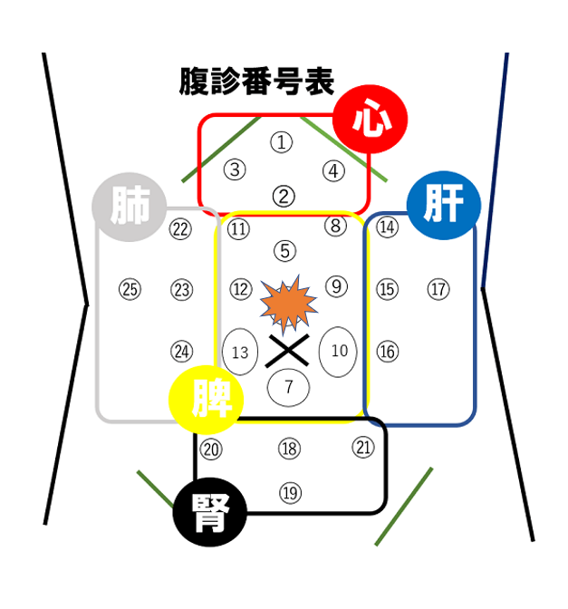 おへそから上2cmあたりにある圧痛