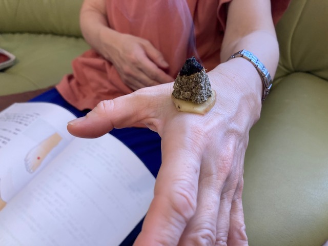 ショウガ灸