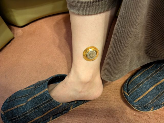 三陰交へのお灸